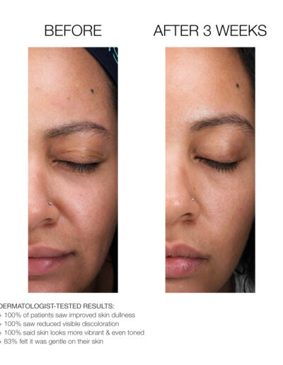 Lactic Acid Micro-Peel | Retexturing & Hydrating Chemical Exfoliant